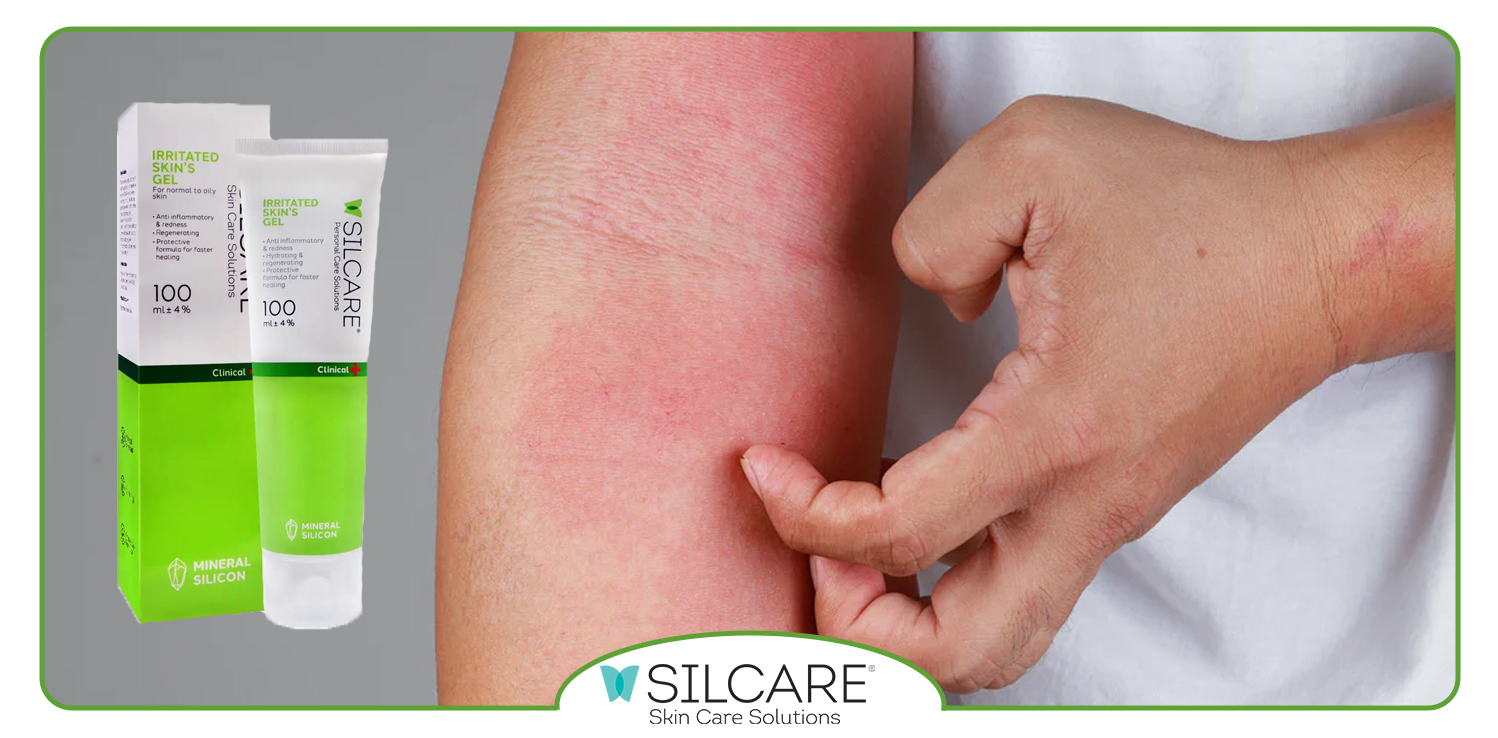 ژل-ترمیم-‌کننده-و-نقش-آن-در-کاهش-قرمزی-و-خارش-پوست