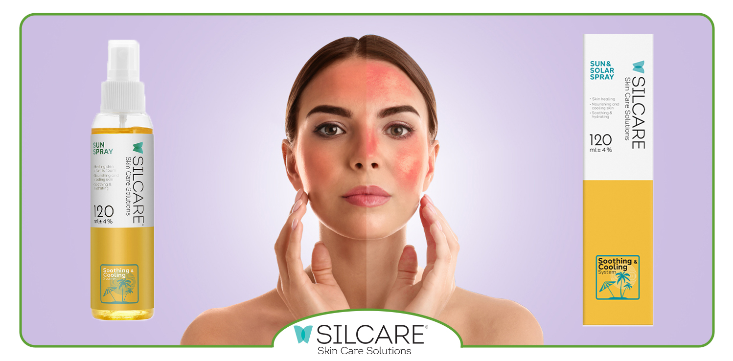 کدام ترکیبات در اسپری آفتاب سوختگی التهاب را کاهش می دهند؟