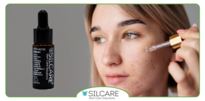 کدام فرمول‌ های سرم ضدجوش آکنه را هدف می‌ گیرند؟